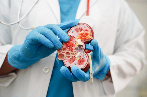 肾结石的诊断方法与标准