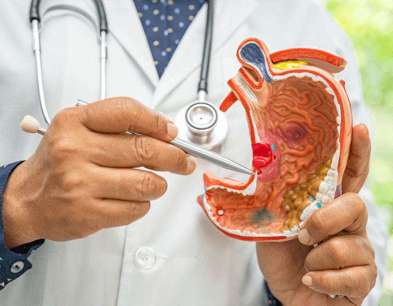 胃癌的常规医疗治疗方案