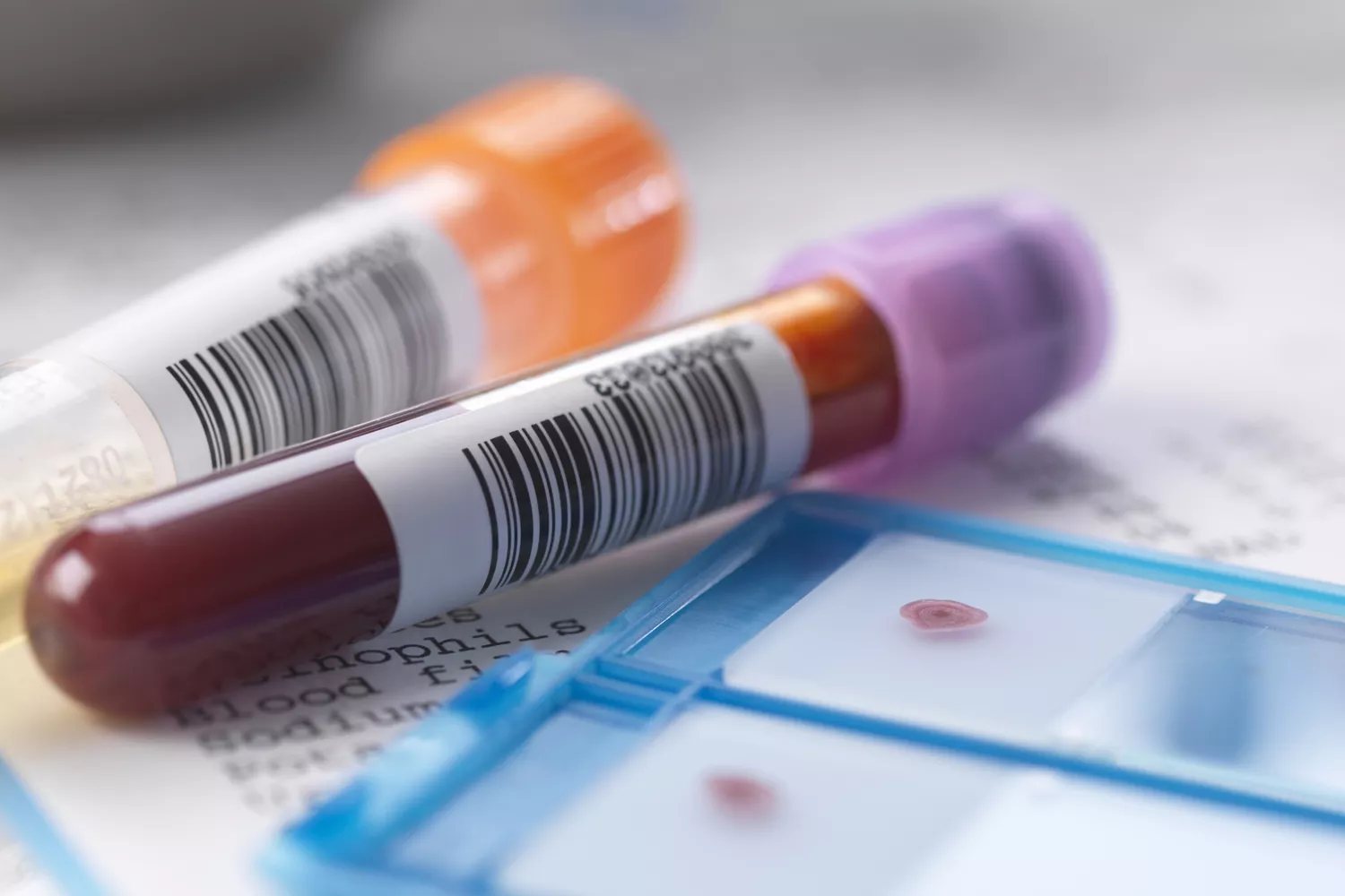 体检结果被“骗”了？胆固醇出现假高假低的10个真相，别让化验单吓到你