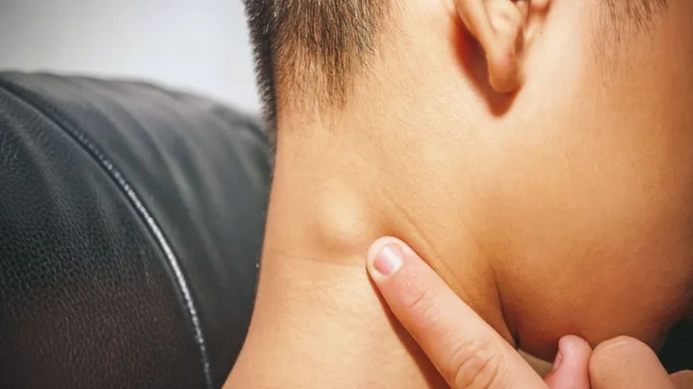 淋巴瘤的治疗性饮食干预