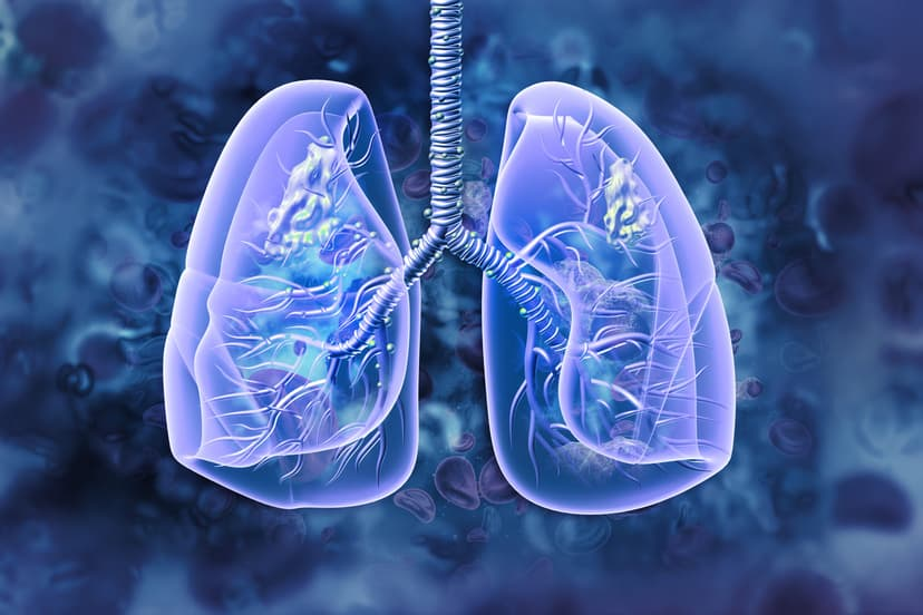 基因驱动的治疗：非小细胞肺癌（NSCLC）报告解读与生命重启指南